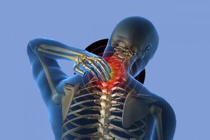 Neck pain