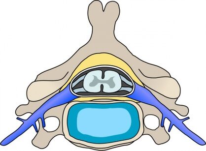 Protabius in the vertebrae and cervical osteochondral disease