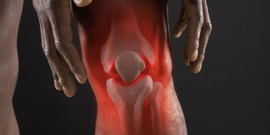 Burning sensation in the knee is a symptom of knee joint disease