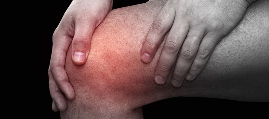 Knee inflammation and discomfort caused by knee arthritis