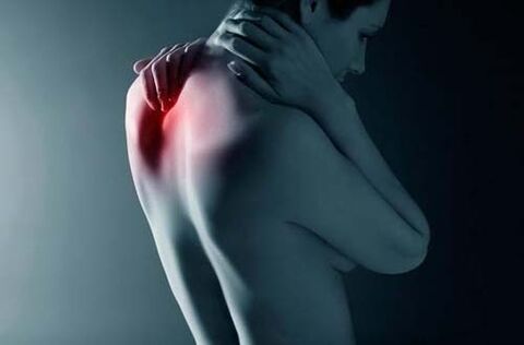 Back pain due to thoracic osteochondrosis